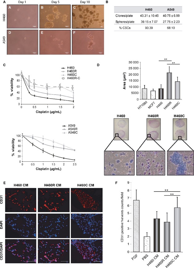 Cancer stem cells and cisplatin-resistant cells isolated from non-small-lung cancer cell lines constitute related cell populations