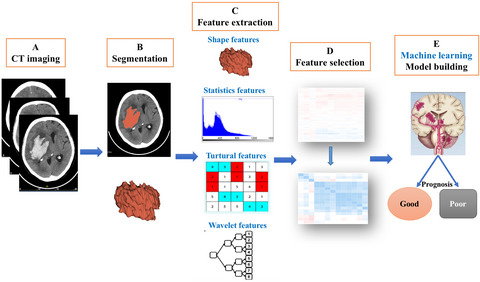 Prognostic prediction of hypertensive intracerebral hemorrhage using CT radiomics and machine learning