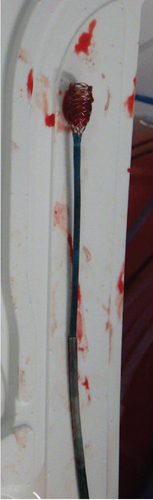 Details are in the caption following the image Details are in the caption following the image