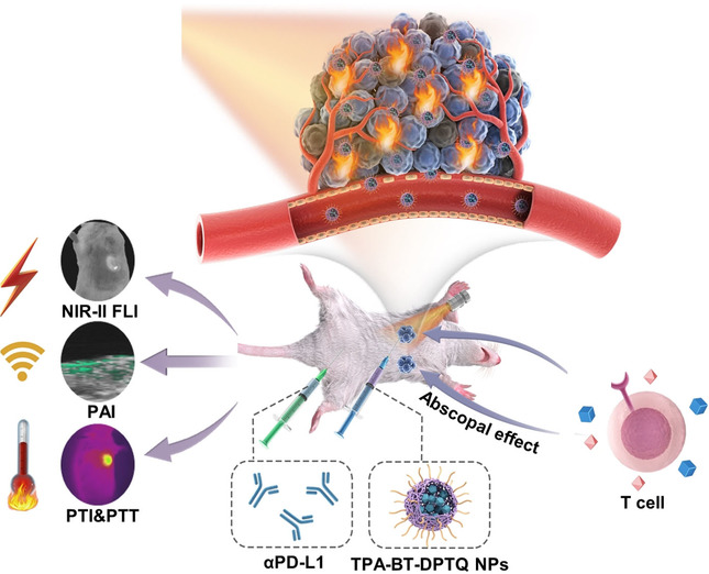 Multimodal Imaging-Guided Photothermal Immunotherapy Based on a Versatile NIR-II Aggregation-Induced Emission Luminogen