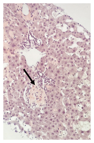 Details are in the caption following the image