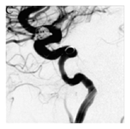 Details are in the caption following the image