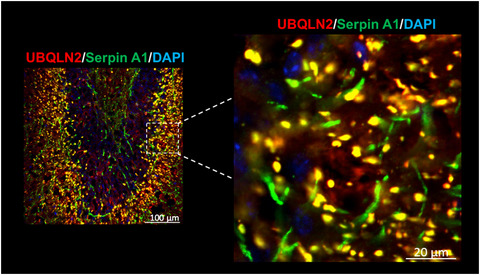 Serpin neuropathology in the P497S UBQLN2 mouse model of ALS/FTD