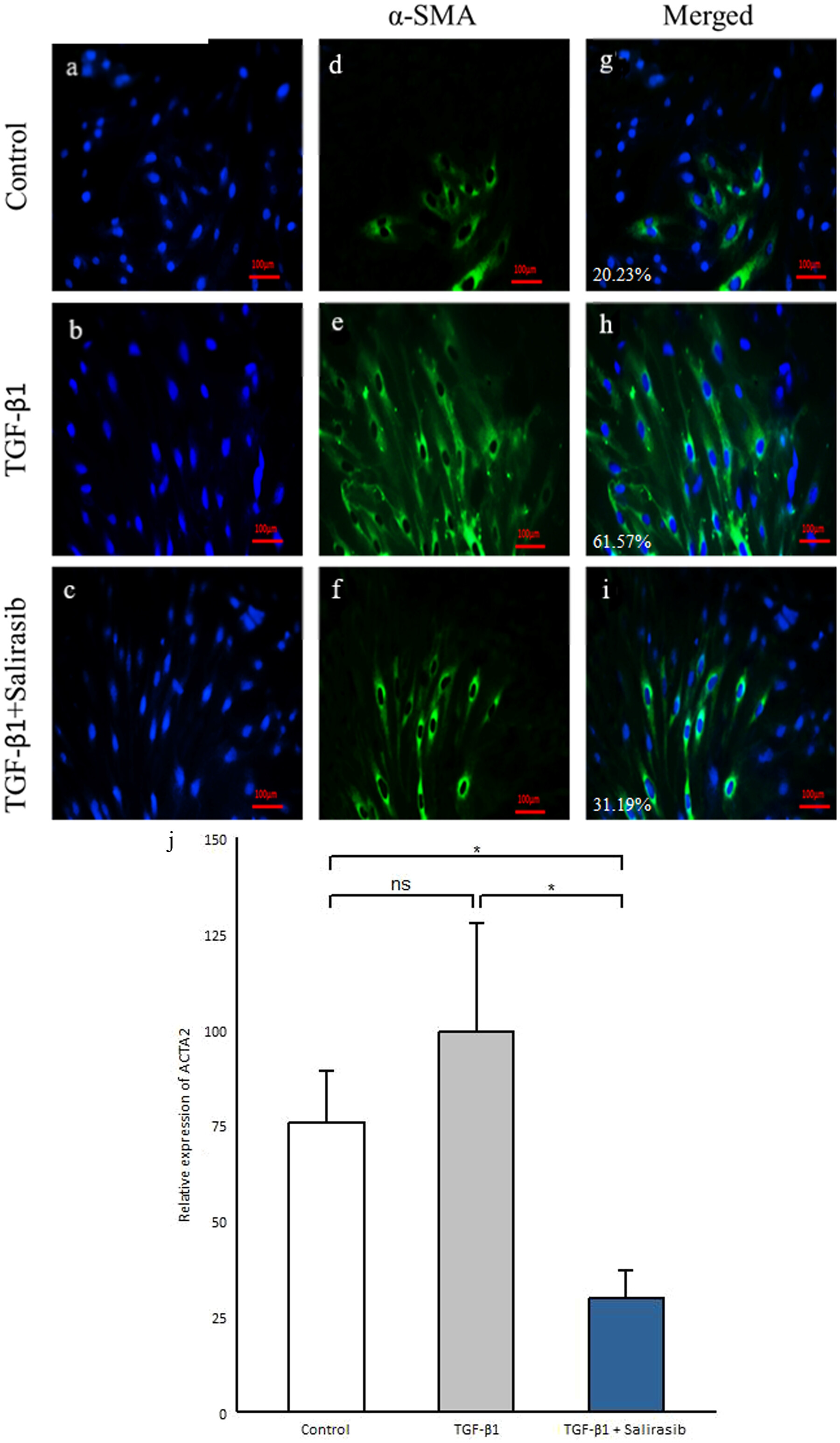 Salirasib Inhibits the Expression of Genes Involved in Fibrosis in Fibroblasts of Systemic Sclerosis Patients