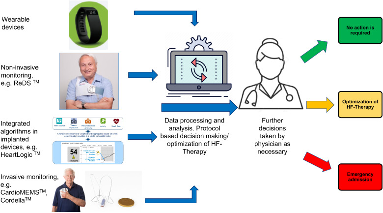 A current and future outlook on upcoming technologies in remote monitoring of patients with heart failure