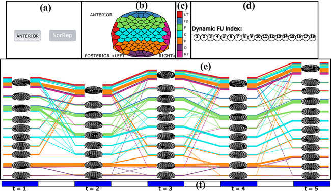Visual Exploration of Dynamic Multichannel EEG Coherence Networks