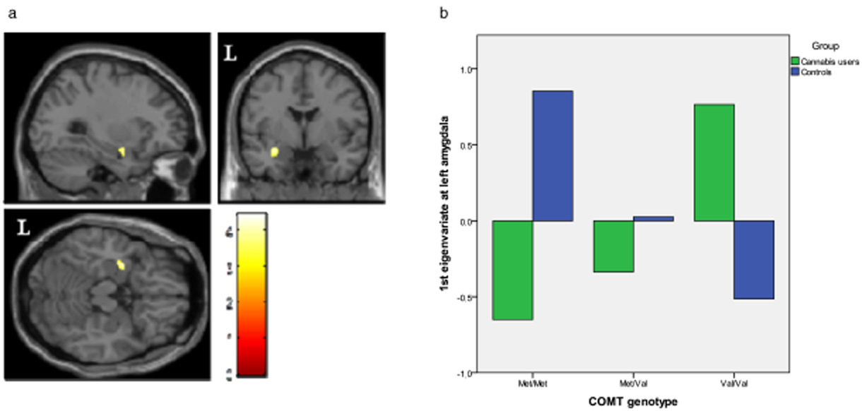Modulation of brain structure by catechol-O-methyltransferase Val158Met polymorphism in chronic cannabis users