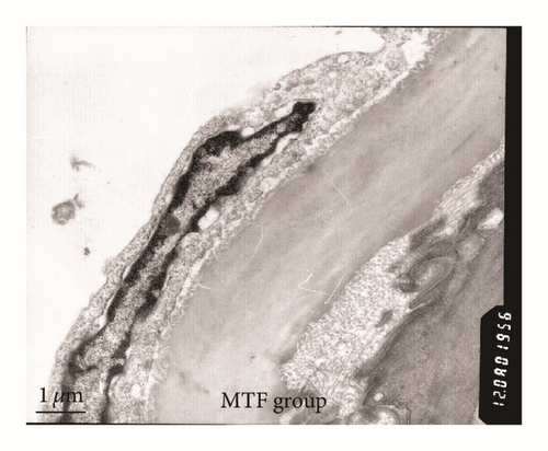 Details are in the caption following the image