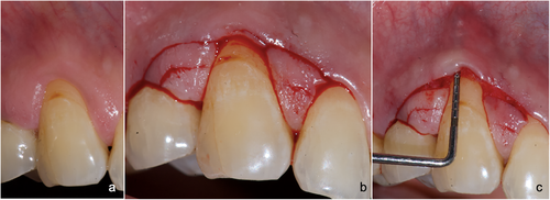 Details are in the caption following the image Details are in the caption following the image