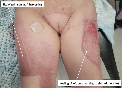 Details are in the caption following the image Details are in the caption following the image