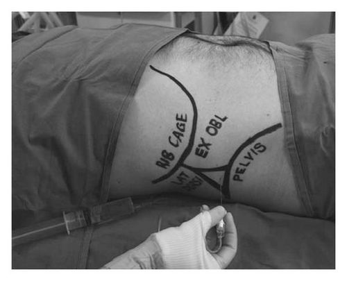 Details are in the caption following the image