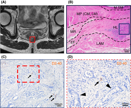 Details are in the caption following the image Details are in the caption following the image