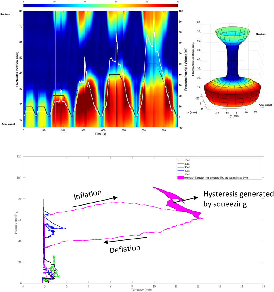 Current and future perspectives on the utility of provocative tests of anal sphincter function: A state-of-the-art summary