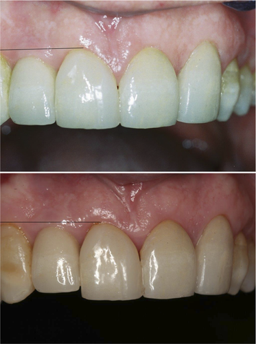 Details are in the caption following the image Details are in the caption following the image