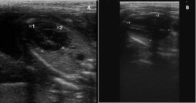 The use of ultrasonographic measurement of the heart size and fetal heart rate variation for gestational age determination in local Bulgarian goats