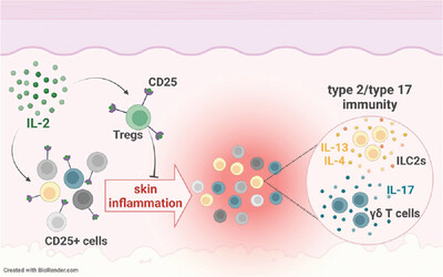 Interleukin-2-induced skin inflammation