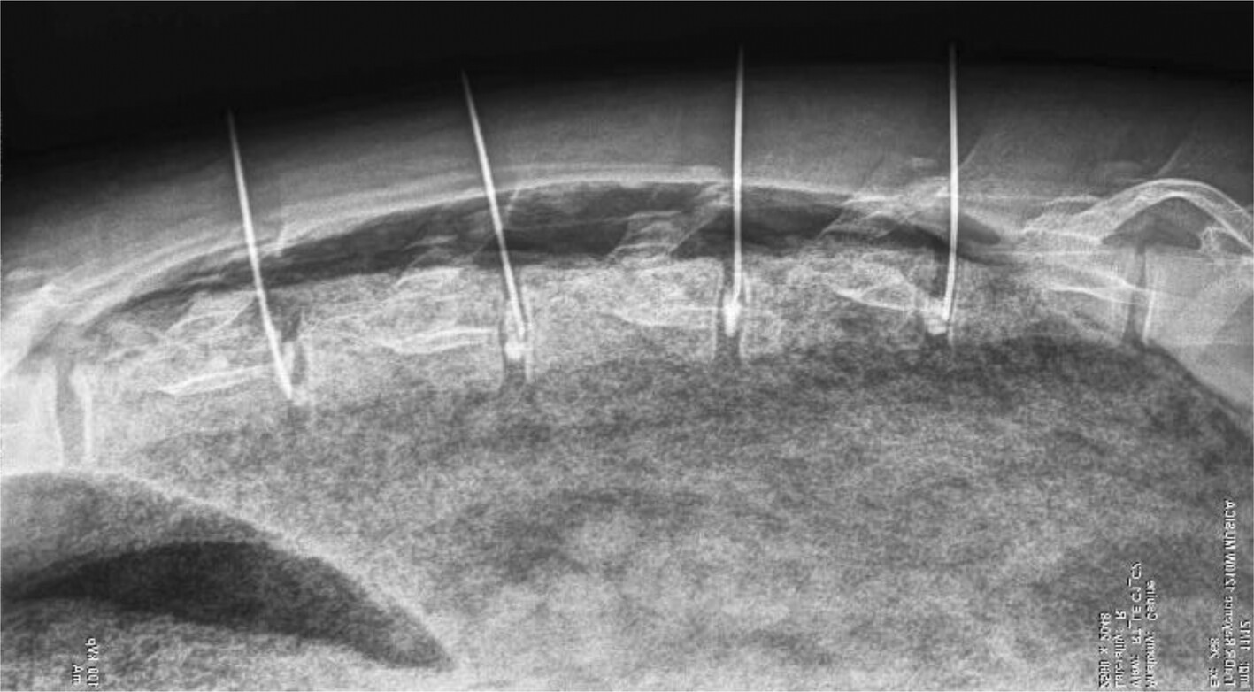 Preclinical development and characterisation of PP353, a formulation of linezolid for intradiscal administration