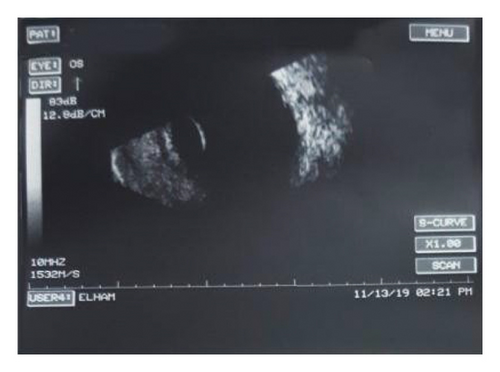 Details are in the caption following the image Details are in the caption following the image