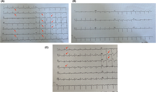 Details are in the caption following the image Details are in the caption following the image