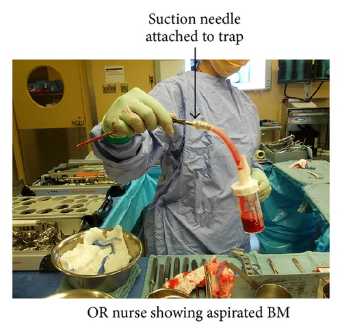 Details are in the caption following the image