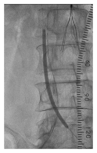 Details are in the caption following the image