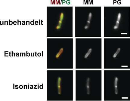 Acute Modulation of Mycobacterial Cell Envelope Biogenesis by Front-Line Tuberculosis Drugs