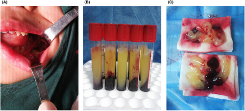 Details are in the caption following the image Details are in the caption following the image