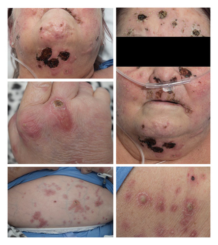 Details are in the caption following the image Details are in the caption following the image