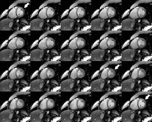 Details are in the caption following the image Details are in the caption following the image