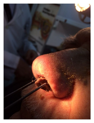 Details are in the caption following the image Details are in the caption following the image