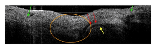 Details are in the caption following the image Details are in the caption following the image