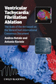 Ventricular Tachycardia/Fibrillation Ablation cover image