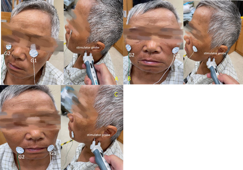 Details are in the caption following the image
