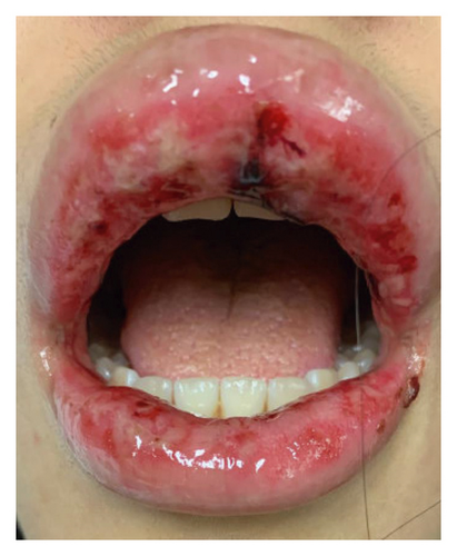 Details are in the caption following the image Details are in the caption following the image