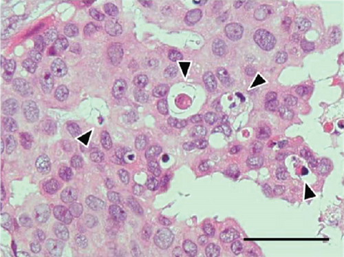 Details are in the caption following the image