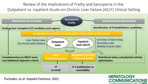 Frailty and Sarcopenia in Acute-on-Chronic Liver Failure