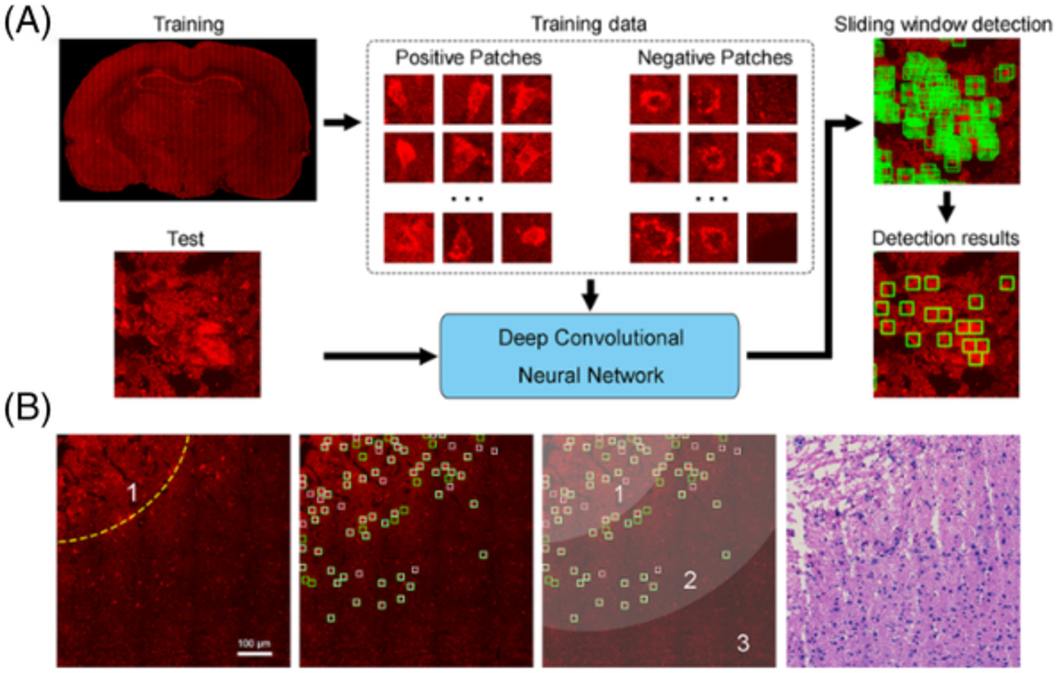 Automated label-free detection of injured neuron with deep learning by two-photon microscopy