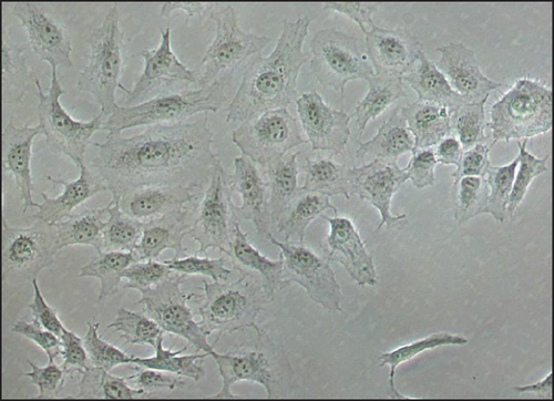 Details are in the caption following the image