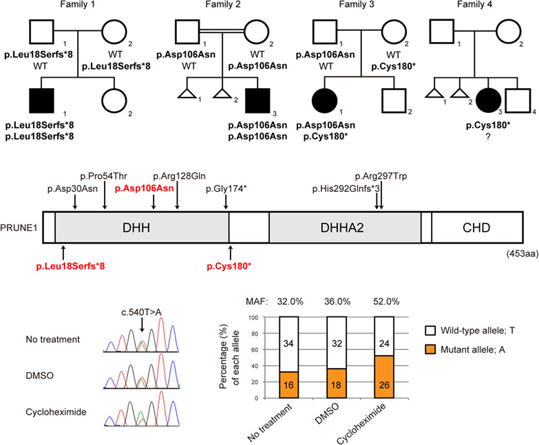 PRUNE1-related disorder: Expanding the clinical spectrum