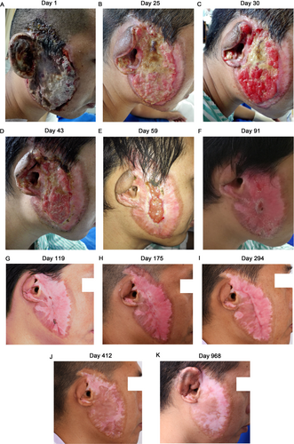 Details are in the caption following the image Details are in the caption following the image
