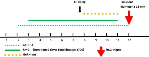 Live birth in a 46-year-old woman using microdose GnRH agonist flare-up protocol combined with GnRH antagonist: a case report
