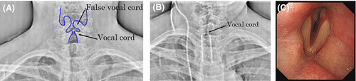 Details are in the caption following the image Details are in the caption following the image