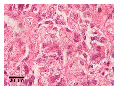 Details are in the caption following the image