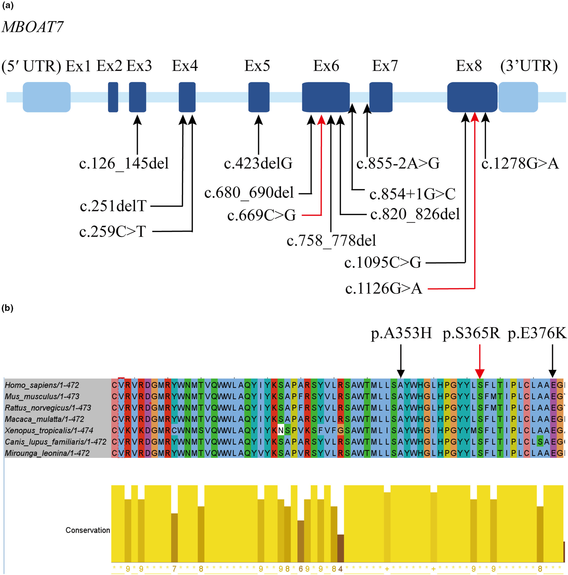 The first Chinese intellectual developmental disorder, autosomal recessive 57 patient with two novel MBOAT7 variants