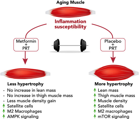 Metformin blunts muscle hypertrophy in response to progressive resistance exercise training in older adults: A randomized, double-blind, placebo-controlled, multicenter trial: The MASTERS trial
