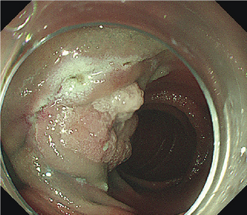 Details are in the caption following the image Details are in the caption following the image