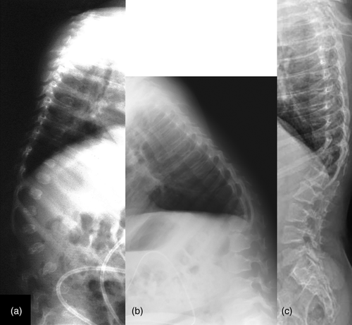 Details are in the caption following the image