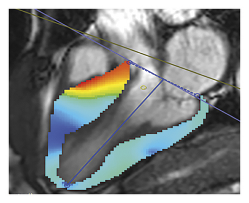 Details are in the caption following the image Details are in the caption following the image