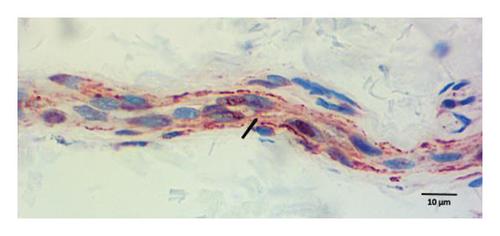 Details are in the caption following the image