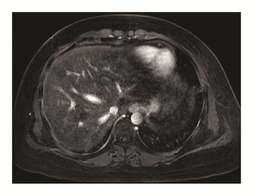 Details are in the caption following the image Details are in the caption following the image